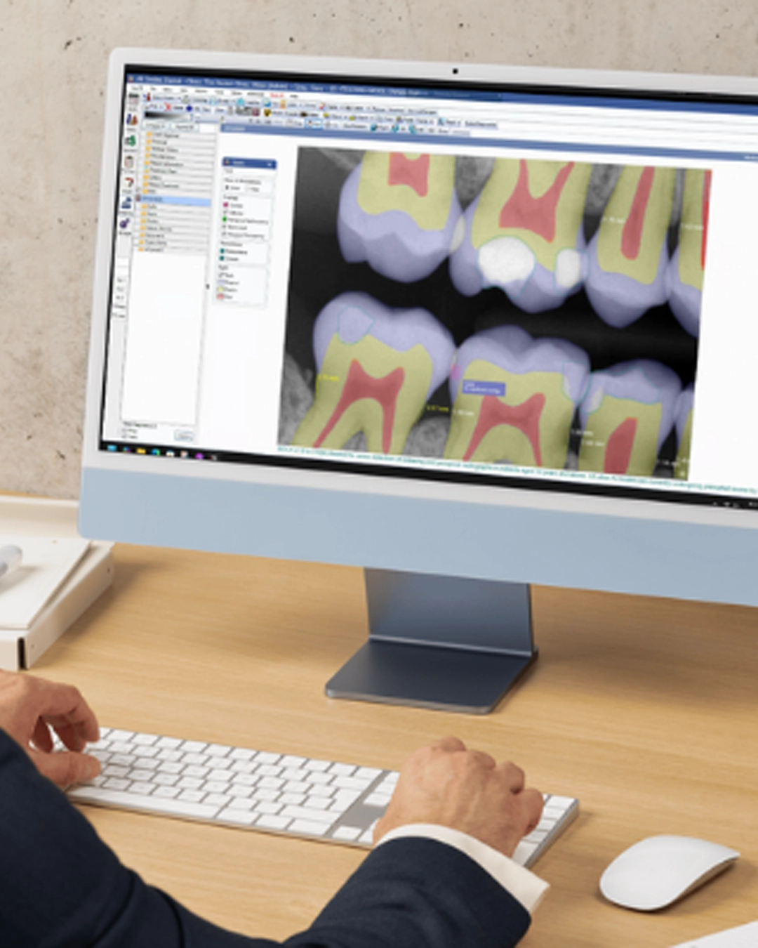 Open Dental software environment support for dental practices